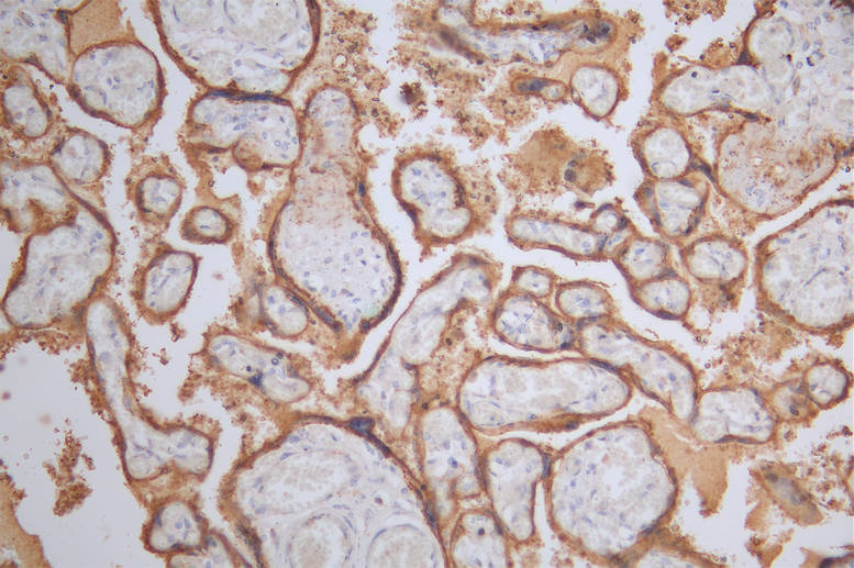 IHC image of ALPP Recombinant Monoclonal Antibody diluted at 1:50 and staining in paraffin-embedded human placenta tissue performed on a Leica BondTM system. After dewaxing and hydration, antigen retrieval was mediated by high pressure in a citrate buffer (pH 6.0). Section was blocked with 10% normal goat serum 30min at RT. Then primary antibody (1% BSA) was incubated at 4°C overnight. The primary is detected by a Goat anti-rabbit polymer IgG labeled by HRP and visualized using 0.39% DAB.