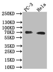 Western Blot | Positive WB detected in: PC-3 whole cell lysate,Hela whole cell lysate | All lanes: Placental alkaline phosphatase (PLAP) antibody at 1:1000 | Secondary | Goat polyclonal to rabbit IgG at 1/50000 dilution | Predicted band size: 70 kDa | Observed band size: 70 kDa