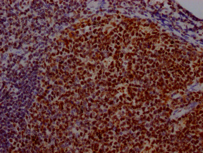 IHC image of USP7 Recombinant Monoclonal Antibody diluted at 1:100 and staining in paraffin-embedded human tonsil tissue performed on a Leica BondTM system. After dewaxing and hydration, antigen retrieval was mediated by high pressure in a citrate buffer (pH 6.0). Section was blocked with 10% normal goat serum 30min at RT. Then primary antibody (1% BSA) was incubated at 4℃ overnight. The primary is detected by a Goat anti-rabbit IgG polymer labeled by HRP and visualized using 0.05% DAB.