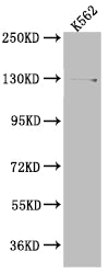 Western Blot | Positive WB detected in: K562 whole cell lysate | All lanes: HAUSP antibody at 1:1000 | Secondary | Goat polyclonal to rabbit IgG at 1/50000 dilution | Predicted band size: 129, 127 kDa | Observed band size: 140 kDa