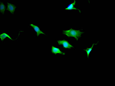 Immunofluorescence staining of SY5Y Cells with TPT1 Recombinant Monoclonal Antibody at 1:50, counter-stained with DAPI. The cells were fixed in 4% formaldehyde, permeated by 0.2% TritonX-100, and blocked in 10% normal Goat Serum. The cells were then incubated with the antibody overnight at 4℃. Nuclear DNA was labeled in blue with DAPI. The secondary antibody was FITC-conjugated AffiniPure Goat Anti-Rabbit IgG (H+L).