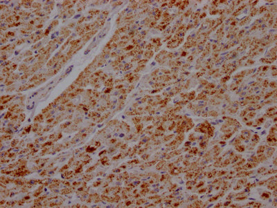 IHC image of ATP5B Recombinant Monoclonal Antibody diluted at 1:100 and staining in paraffin-embedded human heart tissue performed on a Leica BondTM system. After dewaxing and hydration, antigen retrieval was mediated by high pressure in a citrate buffer (pH 6.0). Section was blocked with 10% normal goat serum 30min at RT. Then primary antibody (1% BSA) was incubated at 4℃ overnight. The primary is detected by a Goat anti-rabbit IgG polymer labeled by HRP and visualized using 0.05% DAB.