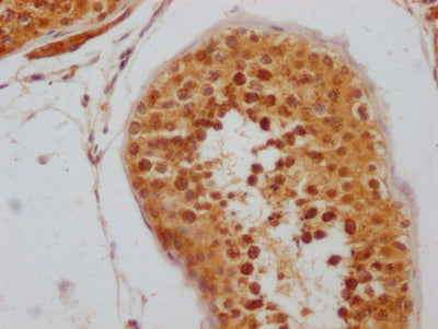 IHC image of RNF20 Recombinant Monoclonal Antibody diluted at 1:100 and staining in paraffin-embedded human testis tissue performed on a Leica BondTM system. After dewaxing and hydration, antigen retrieval was mediated by high pressure in a citrate buffer (pH 6.0). Section was blocked with 10% normal goat serum 30min at RT. Then primary antibody (1% BSA) was incubated at 4℃ overnight. The primary is detected by a Goat anti-rabbit IgG polymer labeled by HRP and visualized using 0.05% DAB.