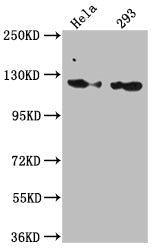 Western Blot | Positive WB detected in: Hela whole cell lysate, 293 whole cell lysate | All lanes: RNF20 antibody at 1:1000 | Secondary | Goat polyclonal to rabbit IgG at 1/50000 dilution | Predicted band size: 114 kDa | Observed band size: 114 kDa