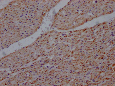 IHC image of UQCRC2 Recombinant Monoclonal Antibody diluted at 1:100 and staining in paraffin-embedded human heart tissue performed on a Leica BondTM system. After dewaxing and hydration, antigen retrieval was mediated by high pressure in a citrate buffer (pH 6.0). Section was blocked with 10% normal goat serum 30min at RT. Then primary antibody (1% BSA) was incubated at 4℃ overnight. The primary is detected by a Goat anti-rabbit IgG polymer labeled by HRP and visualized using 0.05% DAB.