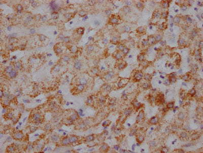 IHC image of UQCRC2 Recombinant Monoclonal Antibody diluted at 1:100 and staining in paraffin-embedded human liver tissue performed on a Leica BondTM system. After dewaxing and hydration, antigen retrieval was mediated by high pressure in a citrate buffer (pH 6.0). Section was blocked with 10% normal goat serum 30min at RT. Then primary antibody (1% BSA) was incubated at 4℃ overnight. The primary is detected by a Goat anti-rabbit IgG polymer labeled by HRP and visualized using 0.05% DAB.