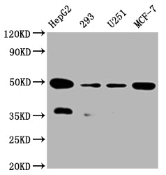 Western Blot | Positive WB detected in:HepG2 whole cell lysate, 293 whole cell lysate, U251 whole cell lysate, MCF-7 whole cell lysate | All lanes: UQCRC2 antibody at 1:2000 | Secondary | Goat polyclonal to rabbit IgG at 1/50000 dilution | Predicted band size: 49 kDa | Observed band size: 49 kDa