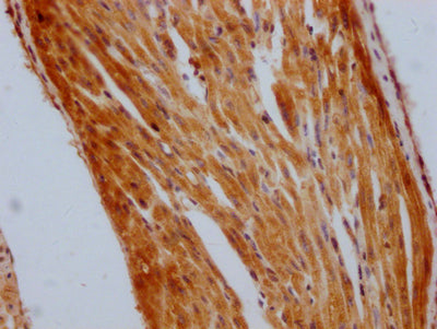 IHC image of STAT3 Recombinant Monoclonal Antibody diluted at 1:100 and staining in paraffin-embedded human heart tissue performed on a Leica BondTM system. After dewaxing and hydration, antigen retrieval was mediated by high pressure in a citrate buffer (pH 6.0). Section was blocked with 10% normal goat serum 30min at RT. Then primary antibody (1% BSA) was incubated at 4℃ overnight. The primary is detected by a Goat anti-rabbit IgG polymer labeled by HRP and visualized using 0.05% DAB.