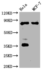 Western Blot | Positive WB detected in:Hela whole cell lysate, MCF-7 whole cell lysate | All lanes: STAT3 antibody at 1:2000 | Secondary | Goat polyclonal to rabbit IgG at 1/50000 dilution | Predicted band size: 89, 88, 84 kDa | Observed band size: 89 kDa