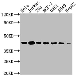 Western Blot | Positive WB detected in: Hela whole cell lysate, Jurkat whole cell lysate, 293 whole cell lysate, MCF-7 whole cell lysate, U251 whole cell lysate, A549 whole cell lysate, HepG2 whole cell lysate | All lanes: AURKB antibody at 1:2000 | Secondary | Goat polyclonal to rabbit IgG at 1/50000 dilution | Predicted band size: 40, 36, 17, 35 kDa | Observed band size: 40 kDa