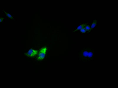 Immunofluorescence staining of HepG2 Cells with TP53 Recombinant Monoclonal Antibody at 1:50, counter-stained with DAPI. The cells were fixed in 4% formaldehyde, permeated by 0.2% TritonX-100, and blocked in 10% normal Goat Serum. The cells were then incubated with the antibody overnight at 4℃. Nuclear DNA was labeled in blue with DAPI. The secondary antibody was FITC-conjugated AffiniPure Goat Anti-Rabbit IgG (H+L).