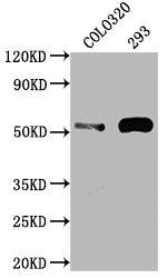 Western Blot | Positive WB detected in: COLO320 whole cell lysate, 293 whole cell lysate | All lanes: TP53 antibody at 1:2000 | Secondary | Goat polyclonal to rabbit IgG at 1/50000 dilution | Predicted band size: 44, 38, 39, 40, 34, 35, 30, 24, 25 kDa | Observed band size: 53 kDa