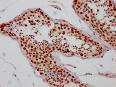 IHC image of SIN3A Recombinant Monoclonal Antibody diluted at 1:100 and staining in paraffin-embedded human testis tissue performed on a Leica BondTM system. After dewaxing and hydration, antigen retrieval was mediated by high pressure in a citrate buffer (pH 6.0). Section was blocked with 10% normal goat serum 30min at RT. Then primary antibody (1% BSA) was incubated at 4℃ overnight. The primary is detected by a Goat anti-rabbit IgG polymer labeled by HRP and visualized using 0.05% DAB.