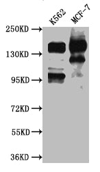 Western Blot | Positive WB detected in: K562 whole cell lysate, MCF-7 whole cell lysate | All lanes: mSin3A antibody at 1:1000 | Secondary | Goat polyclonal to rabbit IgG at 1/50000 dilution | Predicted band size: 146 kDa | Observed band size: 146 kDa