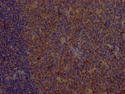 IHC image of CD80 Recombinant Monoclonal Antibody diluted at 1:100 and staining in paraffin-embedded human tonsil tissue performed on a Leica BondTM system. After dewaxing and hydration, antigen retrieval was mediated by high pressure in a citrate buffer (pH 6.0). Section was blocked with 10% normal goat serum 30min at RT. Then primary antibody (1% BSA) was incubated at 4℃ overnight. The primary is detected by a Goat anti-rabbit IgG polymer labeled by HRP and visualized using 0.05% DAB.