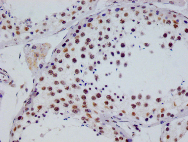 IHC image of the antibody diluted at 1:100 and staining in paraffin-embedded human testis tissue performed on a Leica BondTM system. After dewaxing and hydration, antigen retrieval was mediated by high pressure in a citrate buffer (pH 6.0). Section was blocked with 10% normal goat serum 30min at RT. Then primary antibody (1% BSA) was incubated at 4°C overnight. The primary is detected by a Goat anti-rabbit polymer IgG labeled by HRP and visualized using 0.05% DAB.