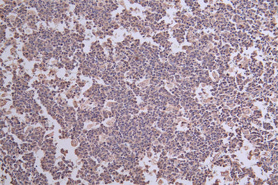 IHC image of the antibody diluted at 1:50 and staining in paraffin-embedded human tonsil tissue performed on a Leica BondTM system. After dewaxing and hydration, antigen retrieval was mediated by high pressure in a citrate buffer (pH 6.0). Section was blocked with 10% normal goat serum 30min at RT. Then primary antibody (1% BSA) was incubated at 4°C overnight. The primary is detected by a Goat anti-rabbit polymer IgG labeled by HRP and visualized using 0.30% DAB.