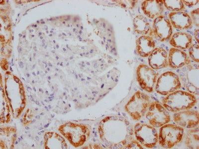 IHC image of AIFM1 Recombinant Monoclonal Antibody diluted at 1:100 and staining in paraffin-embedded human kidney tissue performed on a Leica BondTM system. After dewaxing and hydration, antigen retrieval was mediated by high pressure in a citrate buffer (pH 6.0). Section was blocked with 10% normal goat serum 30min at RT. Then primary antibody (1% BSA) was incubated at 4℃ overnight. The primary is detected by a Goat anti-rabbit IgG polymer labeled by HRP and visualized using 0.05% DAB.