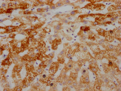 IHC image of AIFM1 Recombinant Monoclonal Antibody diluted at 1:100 and staining in paraffin-embedded human liver tissue performed on a Leica BondTM system. After dewaxing and hydration, antigen retrieval was mediated by high pressure in a citrate buffer (pH 6.0). Section was blocked with 10% normal goat serum 30min at RT. Then primary antibody (1% BSA) was incubated at 4℃ overnight. The primary is detected by a Goat anti-rabbit IgG polymer labeled by HRP and visualized using 0.05% DAB.