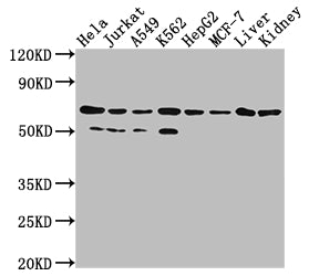 Western Blot | Positive WB detected in: Hela whole cell lysate, Jurkat whole cell lysate, A549 whole cell lysate, HepG2 whole cell lysate, MCF-7 whole cell lysate, Rat liver tissue, Rat kidney tissue | All lanes: AIFM1 antibody at 1:2000 | Secondary | Goat polyclonal to rabbit IgG at 1/50000 dilution | Predicted band size: 67, 36, 29, 27 kDa | Observed band size: 67 kDa