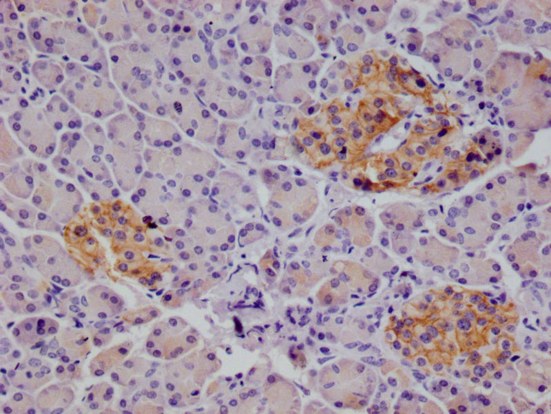 IHC image of ALCAM Recombinant Monoclonal Antibody diluted at 1:100 and staining in paraffin-embedded human pancreatic tissue performed on a Leica BondTM system. After dewaxing and hydration, antigen retrieval was mediated by high pressure in a citrate buffer (pH 6.0). Section was blocked with 10% normal goat serum 30min at RT. Then primary antibody (1% BSA) was incubated at 4°C overnight. The primary is detected by a Goat anti-rabbit polymer IgG labeled by HRP and visualized using 0.05% DAB.