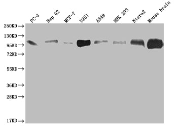 Western Blot | Positive WB detected in: PC3 whole cell lysate, HepG2 whole cell lysate, MCF-7 whole cell lysate, U251 whole cell lysate, A549 whole cell lysate, HEK293 whole cell lysate, Ntera-2 whole cell lysate, Mouse brain tissue | All lanes: ALCAM antibody at 1:2000 | Secondary | Goat polyclonal to rabbit IgG at 1/50000 dilution | Predicted band size: 66, 64, 16, 34 kDa | Observed band size: 100 kDa