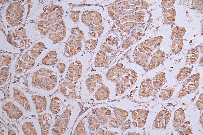 IHC image of the antibody diluted at 1:50 and staining in paraffin-embedded human stomach tissue performed on a Leica BondTM system. After dewaxing and hydration, antigen retrieval was mediated by high pressure in a citrate buffer (pH 6.0). Section was blocked with 10% normal goat serum 30min at RT. Then primary antibody (1% BSA) was incubated at 4°C overnight. The primary is detected by a Goat anti-rabbit polymer IgG labeled by HRP and visualized using 0.13% DAB.