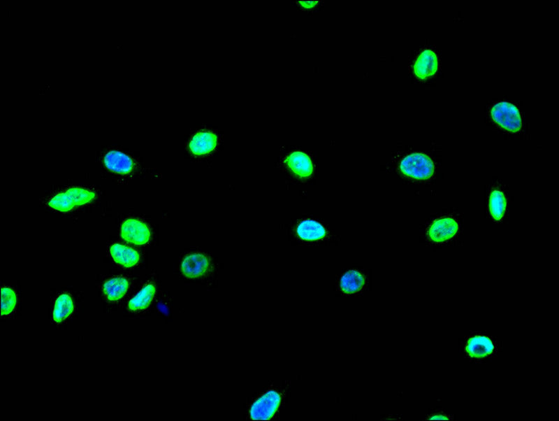 Immunofluorescence staining of A549 with Acetyl-HIST1H3A(K18)  Recombinant Monoclonal Antibody at 1:10, counter-stained with DAPI. The cells were fixed in 4% formaldehyde and blocked in 10% normal Goat Serum. The cells were then incubated with the antibody overnight at 4°C. The secondary antibody was Alexa Fluor 490-congugated AffiniPure Goat Anti-Rabbit IgG(H+L).