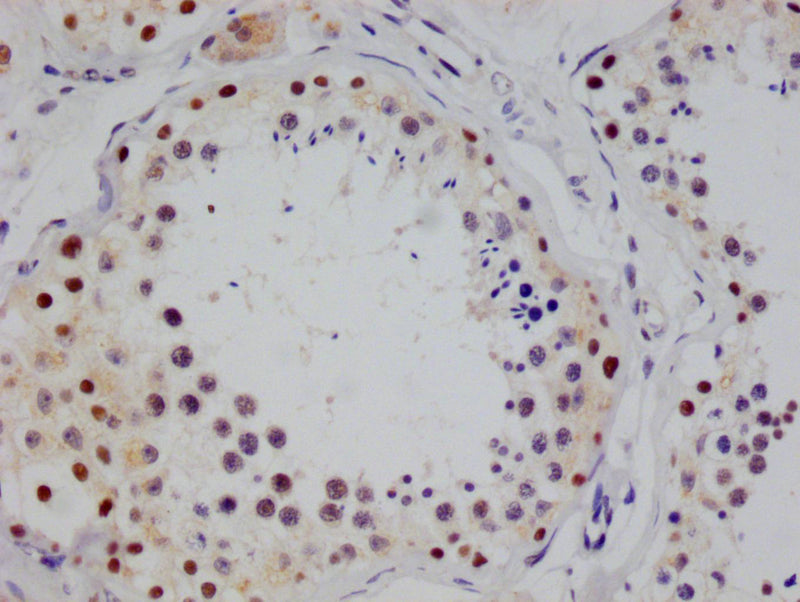 IHC image of the antibody diluted at 1:100 and staining in paraffin-embedded human testis tissue performed on a Leica BondTM system. After dewaxing and hydration, antigen retrieval was mediated by high pressure in a citrate buffer (pH 6.0). Section was blocked with 10% normal goat serum 30min at RT. Then primary antibody (1% BSA) was incubated at 4°C overnight. The primary is detected by a Goat anti-rabbit polymer IgG labeled by HRP and visualized using 0.05% DAB.