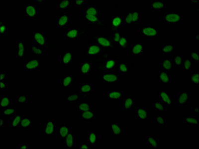 Immunofluorescence staining of Hela Cells with ALDOA Recombinant Monoclonal Antibody at 1:50, counter-stained with DAPI. The cells were fixed in 4% formaldehyde, permeated by 0.2% TritonX-100, and blocked in 10% normal Goat Serum. The cells were then incubated with the antibody overnight at 4℃. Nuclear DNA was labeled in blue with DAPI. The secondary antibody was FITC-conjugated AffiniPure Goat Anti-Rabbit IgG (H+L).