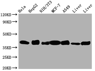 Western Blot | Positive WB detected in: Hela whole cell lysate, HepG2 whole cell lysate, NIH/3T3 whole cell lysate, A549 whole cell lysate, Mouse Liver whole cell lysate, Rat Liver whole cell lysate | All lanes: Aldolase antibody at 1:1000 | Secondary | Goat polyclonal to rabbit IgG at 1/50000 dilution | Predicted band size: 40, 46 kDa | Observed band size: 40 kDa