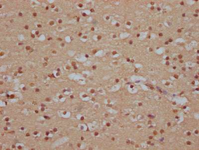 IHC image of SOX10 Recombinant Monoclonal Antibody diluted at 1:100 and staining in paraffin-embedded human brain tissue performed on a Leica BondTM system. After dewaxing and hydration, antigen retrieval was mediated by high pressure in a citrate buffer (pH 6.0). Section was blocked with 10% normal goat serum 30min at RT. Then primary antibody (1% BSA) was incubated at 4℃ overnight. The primary is detected by a Goat anti-rabbit IgG polymer labeled by HRP and visualized using 0.05% DAB.