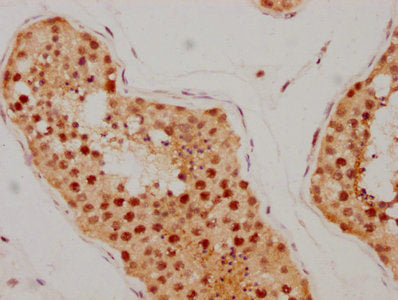 IHC image of ATM Recombinant Monoclonal Antibody diluted at 1:205 and staining in paraffin-embedded human testis tissue performed on a Leica BondTM system. After dewaxing and hydration, antigen retrieval was mediated by high pressure in a citrate buffer (pH 6.0). Section was blocked with 10% normal goat serum 30min at RT. Then primary antibody (1% BSA) was incubated at 4℃ overnight. The primary is detected by a biotinylated secondary antibody and visualized using an HRP conjugated SP system.