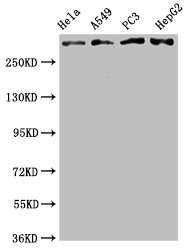 Western Blot | Positive WB detected in: Hela whole cell lysate, A549 whole cell lysate, PC3 whole cell lysate, HepG2 whole cell lysate | All lanes: ATM antibody at 2.05μg/ml | Secondary | Goat polyclonal to rabbit IgG at 1/50000 dilution | Predicted band size: 350 KDa | Observed band size: 350 KDa