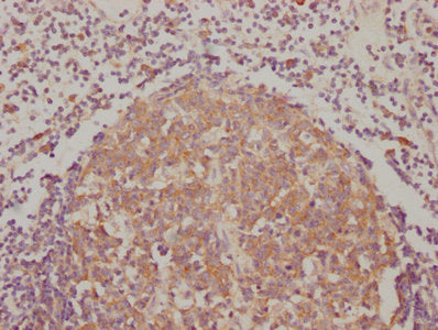 IHC image of BAK1 Recombinant Monoclonal Antibody diluted at 1:90 and staining in paraffin-embedded human lymph node tissue performed on a Leica BondTM system. After dewaxing and hydration, antigen retrieval was mediated by high pressure in a citrate buffer (pH 6.0). Section was blocked with 10% normal goat serum 30min at RT. Then primary antibody (1% BSA) was incubated at 4℃ overnight. The primary is detected by a biotinylated secondary antibody and visualized using an HRP conjugated SP system.