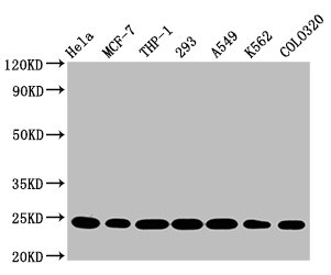 Western Blot | Positive WB detected in: Hela whole cell lysate, MCF-7 whole cell lysate, THP-1 whole cell lysate, 293 whole cell lysate, A549 whole cell lysate, K562 whole cell lysate, Colo320 whole cell lysate | All lanes: BAK1 antibody at 0.9μg/ml | Secondary | Goat polyclonal to rabbit IgG at 1/50000 dilution | Predicted band size: 24, 17 KDa | Observed band size: 24 KDa