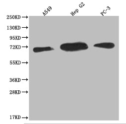 Western Blot | Positive WB detected in: A549 whole cell lysate, HepG2 whole cell lysate, PC3 whole cell lysate | All lanes: USP22 antibody at 1:2000 | Secondary | Goat polyclonal to rabbit IgG at 1/50000 dilution | Predicted band size: 60, 59 kDa | Observed band size: 55-72 kDa