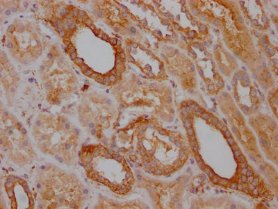 IHC image of TRAF2 Recombinant Monoclonal Antibody diluted at 1:100 and staining in paraffin-embedded human kidney tissue performed on a Leica BondTM system. After dewaxing and hydration, antigen retrieval was mediated by high pressure in a citrate buffer (pH 6.0). Section was blocked with 10% normal goat serum 30min at RT. Then primary antibody (1% BSA) was incubated at 4℃ overnight. The primary is detected by a Goat anti-rabbit IgG polymer labeled by HRP and visualized using 0.05% DAB.