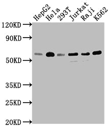 Western Blot | Positive WB detected in: HepG2 whole cell lysate, Hela whole cell lysate, 293T whole cell lysate, Jurkat whole cell lysate, Raji whole cell lysate, K562 whole cell lysate | All lanes: TRAF2 antibody at 1:1500 | Secondary | Goat polyclonal to rabbit IgG at 1/50000 dilution | Predicted band size: 56, 62, 55, 54 kDa | Observed band size: 56 kDa