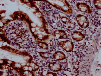 IHC image of TOP1 Recombinant Monoclonal Antibody diluted at 1:100 and staining in paraffin-embedded human small intestine tissue performed on a Leica BondTM system. After dewaxing and hydration, antigen retrieval was mediated by high pressure in a citrate buffer (pH 6.0). Section was blocked with 10% normal goat serum 30min at RT. Then primary antibody (1% BSA) was incubated at 4℃ overnight. The primary is detected by a Goat anti-rabbit IgG polymer labeled by HRP and visualized using 0.05% DAB.