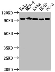 Western Blot | Positive WB detected in: Hela whole cell lysate, MCF-7 whole cell lysate, K562 whole cell lysate, HL60 whole cell lysate, PC-3 whole cell lysate | All lanes: TOP1 antibody at 1:2000 | Secondary | Goat polyclonal to rabbit IgG at 1/50000 dilution | Predicted band size: 91 kDa | Observed band size: 91 kDa