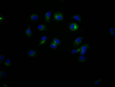 Immunofluorescence staining of MCF7 Cells with CD47 Recombinant Monoclonal Antibody at 1:50, counter-stained with DAPI. The cells were fixed in 4% formaldehyde, permeated by 0.2% TritonX-100, and blocked in 10% normal Goat Serum. The cells were then incubated with the antibody overnight at 4℃. Nuclear DNA was labeled in blue with DAPI. The secondary antibody was FITC-conjugated AffiniPure Goat Anti-Rabbit IgG (H+L).