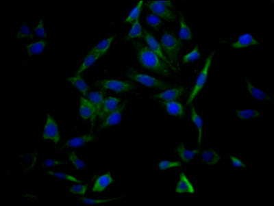 Immunofluorescence staining of HepG2 Cells with TP53 Recombinant Monoclonal Antibody at 1:50, counter-stained with DAPI. The cells were fixed in 4% formaldehyde, permeated by 0.2% TritonX-100, and blocked in 10% normal Goat Serum. The cells were then incubated with the antibody overnight at 4℃. Nuclear DNA was labeled in blue with DAPI. The secondary antibody was FITC-conjugated AffiniPure Goat Anti-Rabbit IgG (H+L).