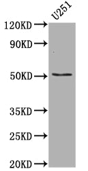 Western Blot | Positive WB detected in: U-251 whole cell lysate | All lanes: Mutant p53 antibody at 1:1000 | Secondary | Goat polyclonal to rabbit IgG at 1/50000 dilution | Predicted band size: 38, 39, 40, 34, 35, 30, 24, 25 kDa | Observed band size: 53 kDa