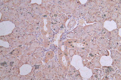 IHC image of TUBB1 Recombinant Monoclonal Antibody diluted at 1:300 and staining in paraffin-embedded human pancreatic tissue performed on a Leica BondTM system. After dewaxing and hydration, antigen retrieval was mediated by high pressure in a citrate buffer (pH 6.0). Section was blocked with 10% normal goat serum 30min at RT. Then primary antibody (1% BSA) was incubated at 4°C overnight. The primary is detected by a Goat anti-Mouse IgG labeled by HRP and visualized using 0.05% DAB.