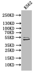 Western Blot | Positive WB detected in: K562 whole cell lysate | All lanes: TUBB1 antibody at 1:1000 | Secondary | Goat polyclonal to mouse IgG at 1/50000 dilution | Predicted band size: 50 kDa | Observed band size: 50 kDa