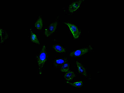 Immunofluorescence staining of A549 cell with ROBO1 Recombinant Monoclonal Antibody at 1:20, counter-stained with DAPI. The cells were fixed in 4% formaldehyde and blocked in 10% normal Goat Serum. The cells were then incubated with the antibody overnight at 4C. The secondary antibody was FITC-conjugated AffiniPure Goat Anti-Mouse IgG(H+L).