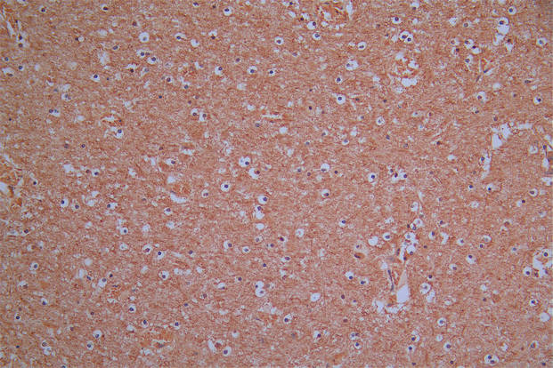 IHC image of the antibody diluted at 1:30 and staining in paraffin-embedded human brain tissue performed on a Leica BondTM system. After dewaxing and hydration, antigen retrieval was mediated by high pressure in a citrate buffer (pH 6.0). Section was blocked with 10% normal goat serum 30min at RT. Then primary antibody (1% BSA) was incubated at 4°C overnight. The primary is detected by a Goat anti-Mouse IgG labeled by HRP and visualized using 0.05% DAB.