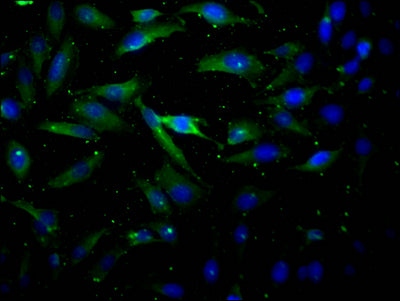 Immunofluorescence staining of Hela Cells with AKT1 Recombinant Monoclonal Antibody at 1:50, counter-stained with DAPI. The cells were fixed in 4% formaldehyde, permeated by 0.2% TritonX-100, and blocked in 10% normal Goat Serum. The cells were then incubated with the antibody overnight at 4℃. Nuclear DNA was labeled in blue with DAPI. The secondary antibody was FITC-conjugated AffiniPure Goat Anti-Rabbit IgG (H+L).