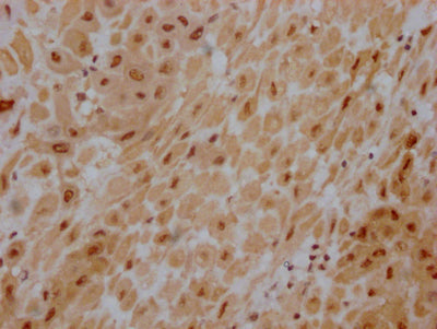 IHC image of AKT1 Recombinant Monoclonal Antibody diluted at 1:100 and staining in paraffin-embedded human placenta tissue performed on a Leica BondTM system. After dewaxing and hydration, antigen retrieval was mediated by high pressure in a citrate buffer (pH 6.0). Section was blocked with 10% normal goat serum 30min at RT. Then primary antibody (1% BSA) was incubated at 4℃ overnight. The primary is detected by a Goat anti-rabbit IgG polymer labeled by HRP and visualized using 0.05% DAB.